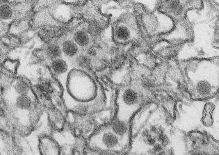 U.S. issues treatment guidelines for infants exposed to Zika