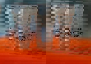 First U.S. Zika virus transmission reported, attributed to sex