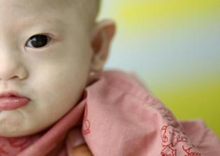 Ohio governor approves measure banning abortions of unborn babies with Down syndrome