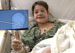 Family thanks God for miracle after boy survives being impaled