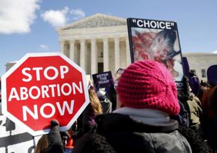 3 out of 4 Americans support 'significant restrictions' on abortions, poll shows